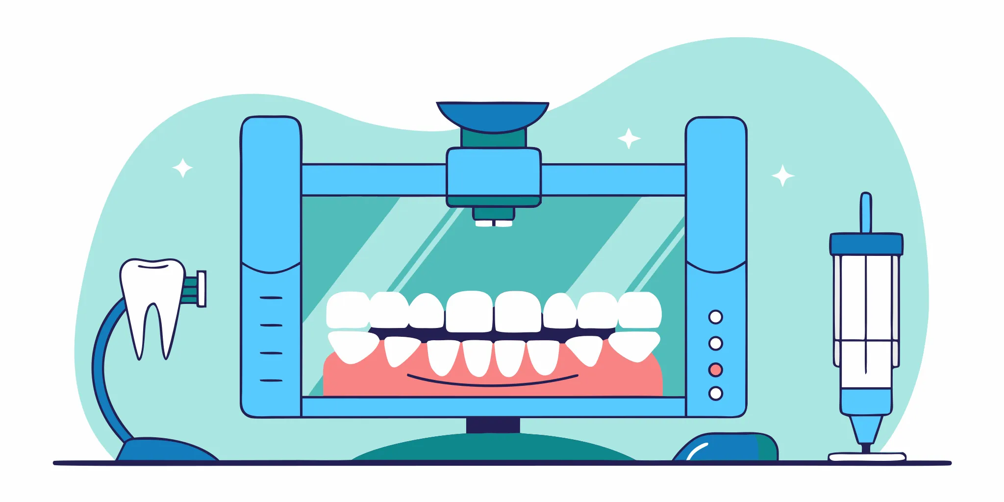 A custom mandibular advancement device designed for sleep apnea treatment shown on a dental model in a clinical setting.